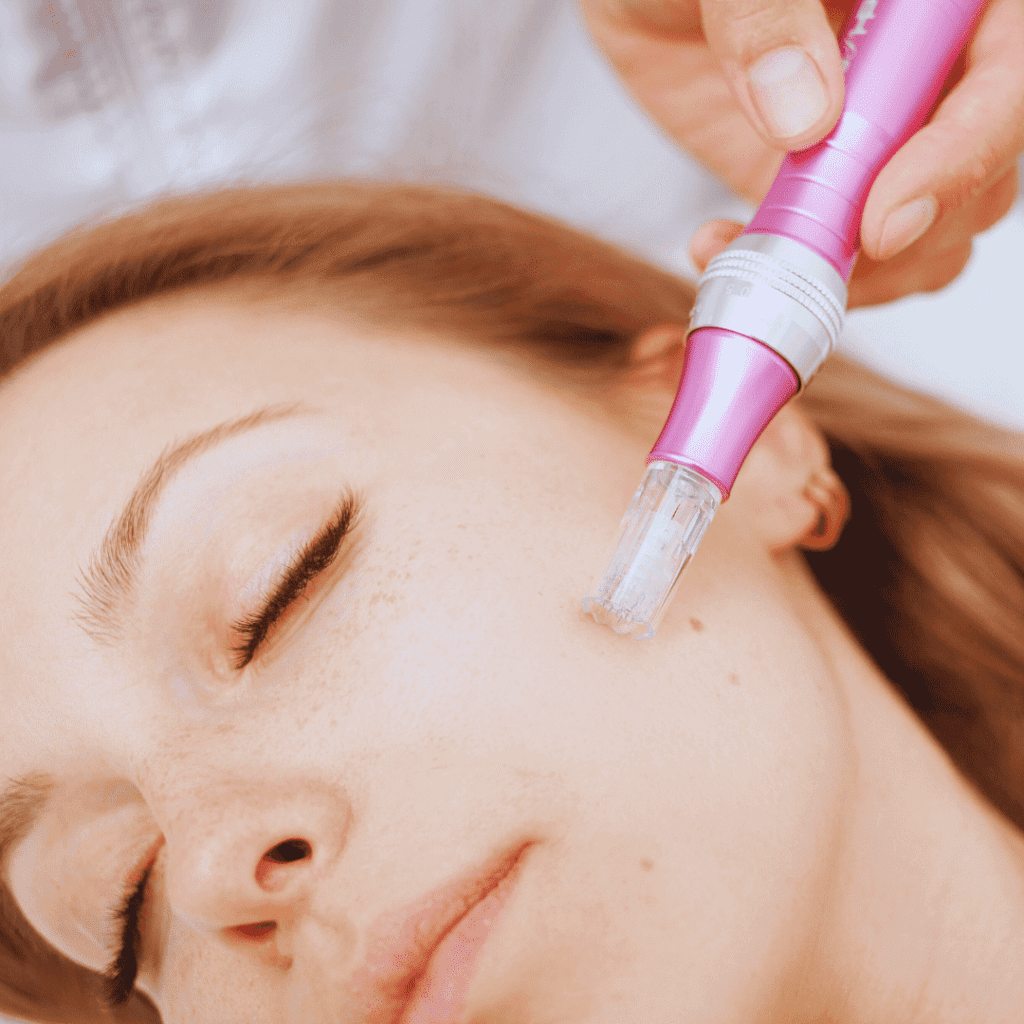 Micro needling