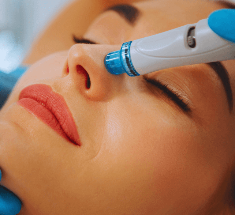 Hydrodermabrasion