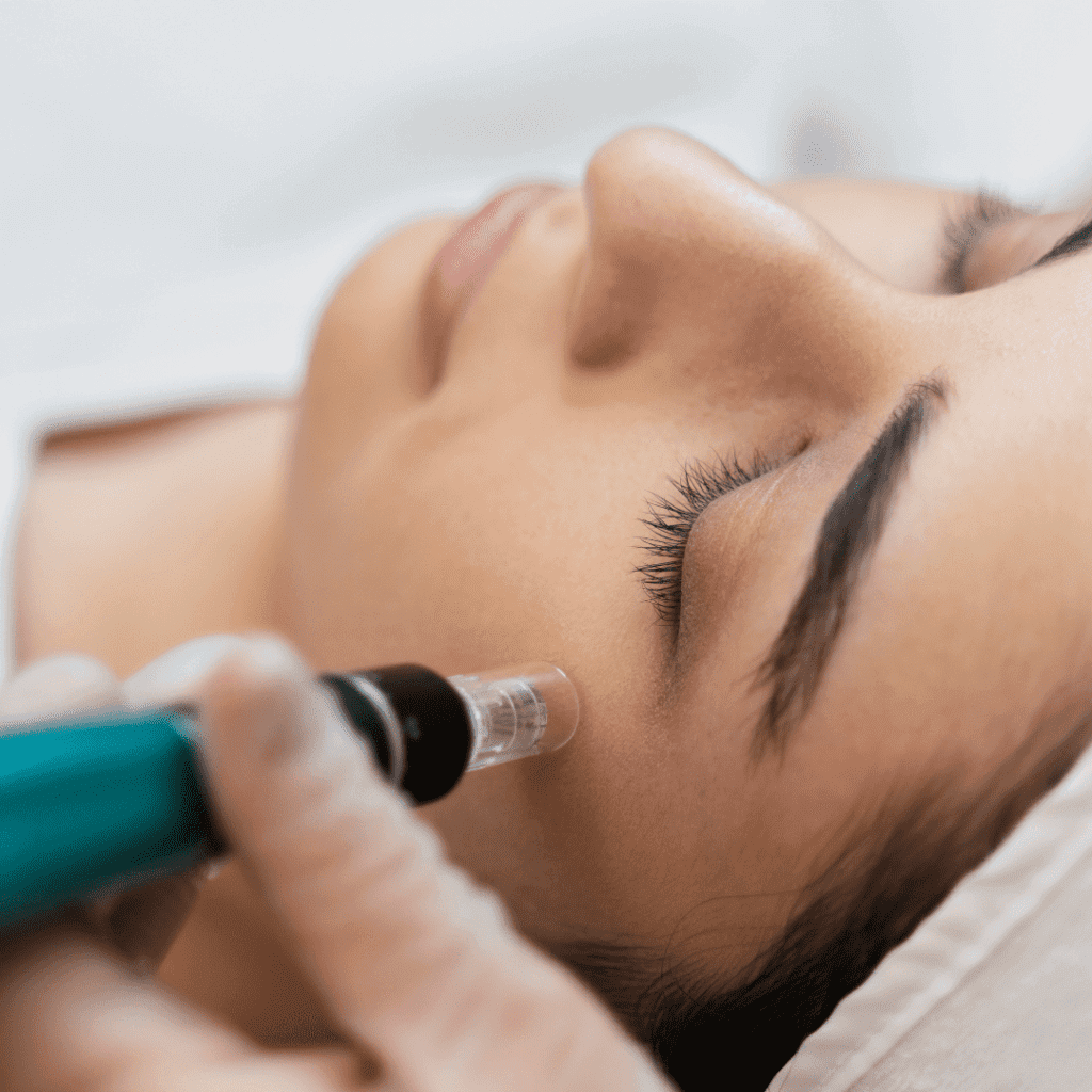 Micro needling