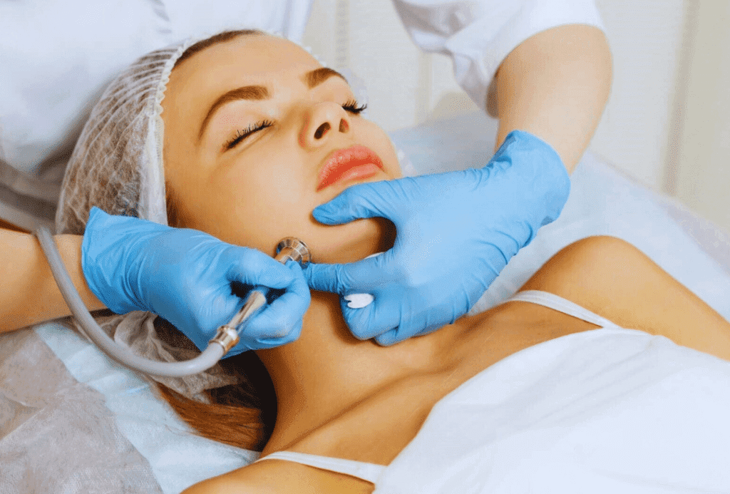 Micro dermabrasion