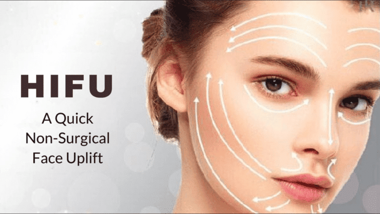 Non-Surgical-Face-Lift