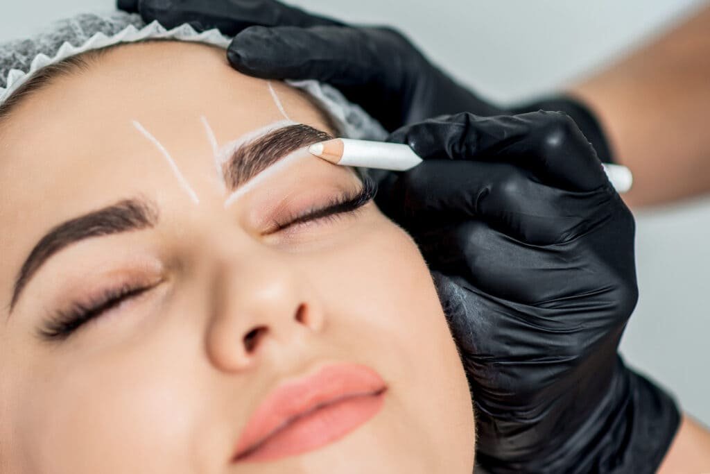 brow lift