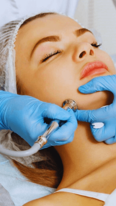 MICRODERMABRASION