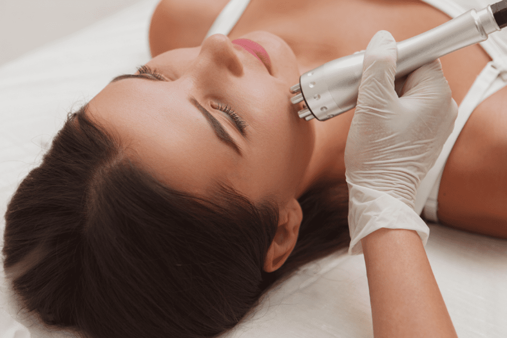 RF Skin Tightening